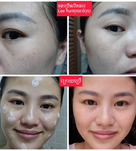 Peptide Whitening Cream គ្រីមជួយបំបាត់អាច៏រុយស្នាមជាំ