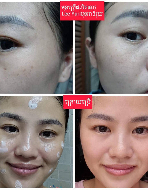 Load image into Gallery viewer, Peptide Whitening Cream គ្រីមជួយបំបាត់អាច៏រុយស្នាមជាំ
