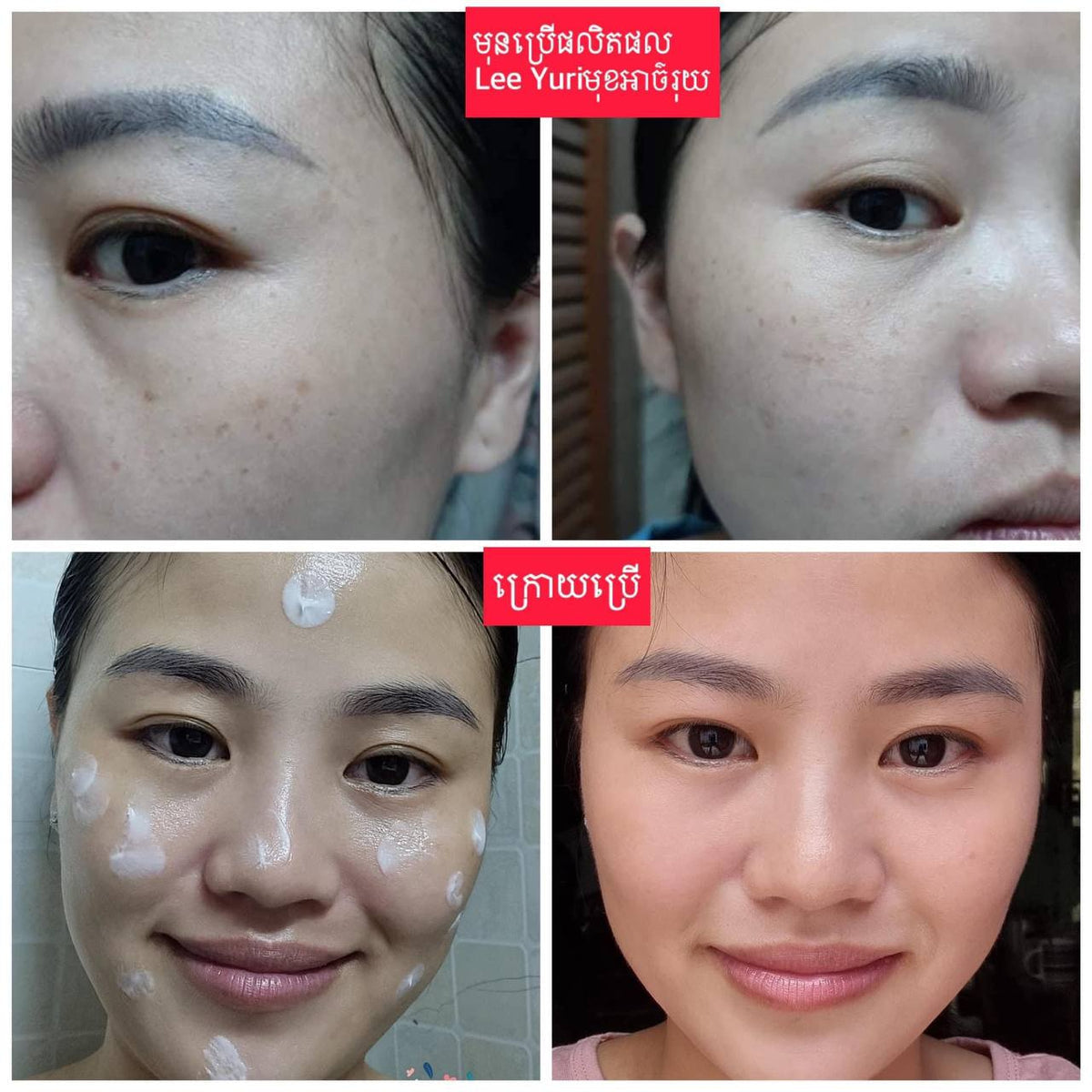 Peptide Whitening Cream គ្រីមជួយបំបាត់អាច៏រុយស្នាមជាំ