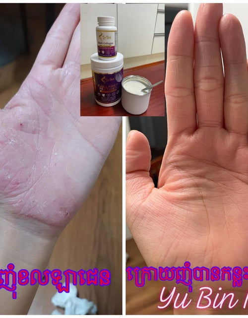 Load image into Gallery viewer, Collagen Pill កូឡាជែនគ្រាប់
