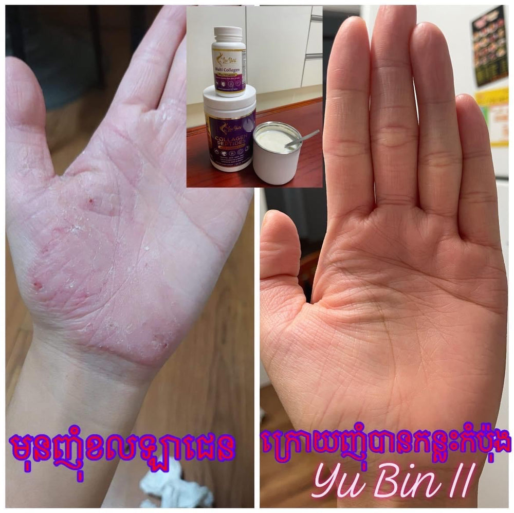 Collagen Pill កូឡាជែនគ្រាប់