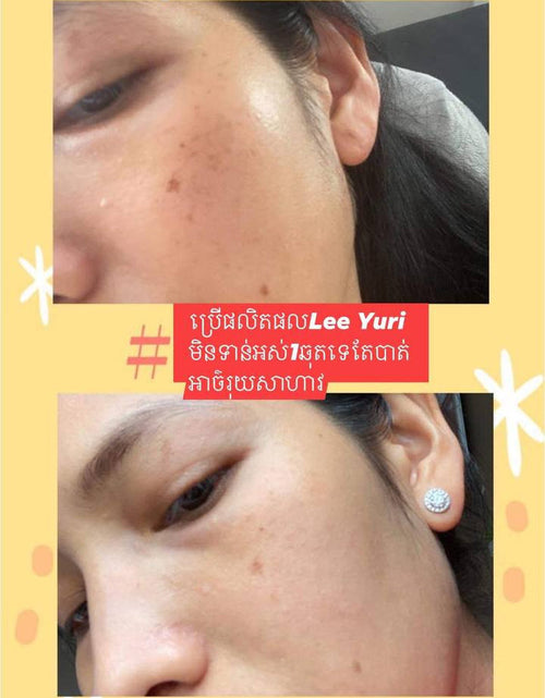 Load image into Gallery viewer, Peptide Whitening Cream គ្រីមជួយបំបាត់អាច៏រុយស្នាមជាំ
