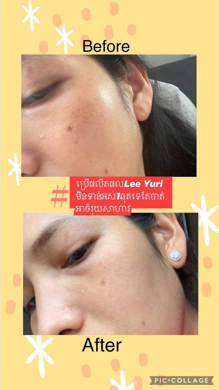 Peptide Whitening Cream គ្រីមជួយបំបាត់អាច៏រុយស្នាមជាំ