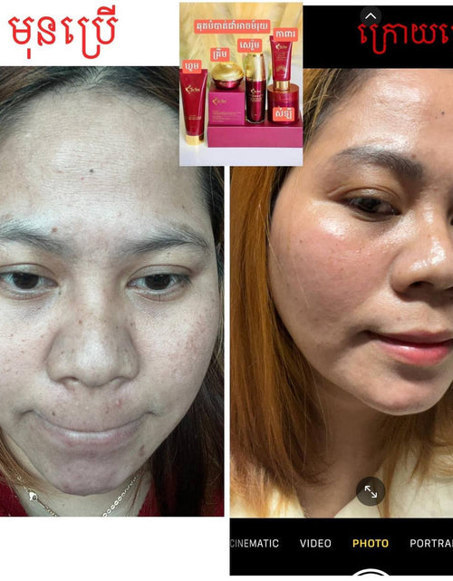 Load image into Gallery viewer, Peptide Whitening Cream គ្រីមជួយបំបាត់អាច៏រុយស្នាមជាំ
