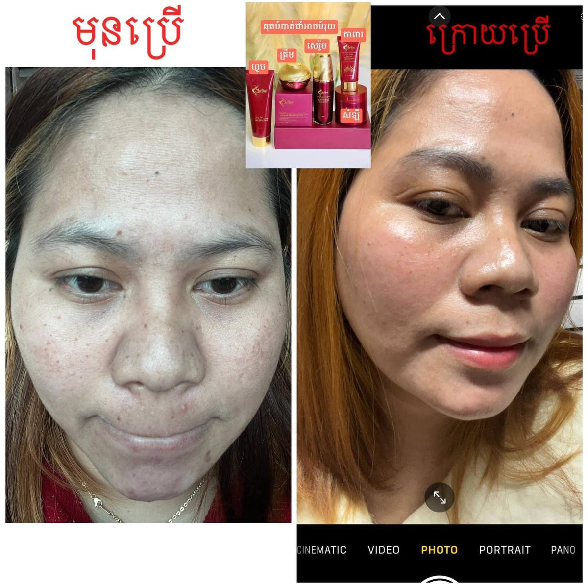 Peptide Whitening Cream គ្រីមជួយបំបាត់អាច៏រុយស្នាមជាំ