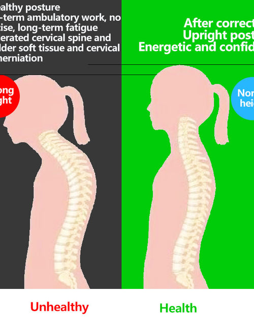 Load image into Gallery viewer, Back Posture Corrector(Shipping 10-14 Days)
